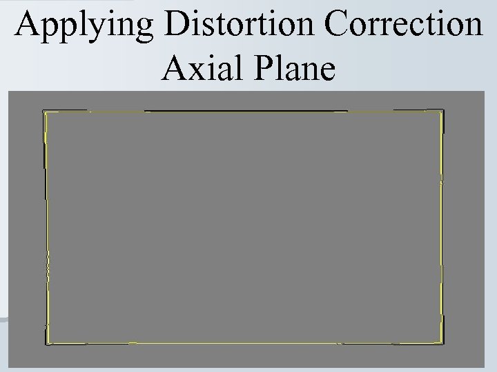 Applying Distortion Correction Axial Plane 