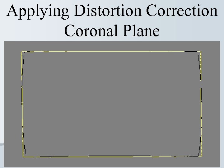 Applying Distortion Correction Coronal Plane 