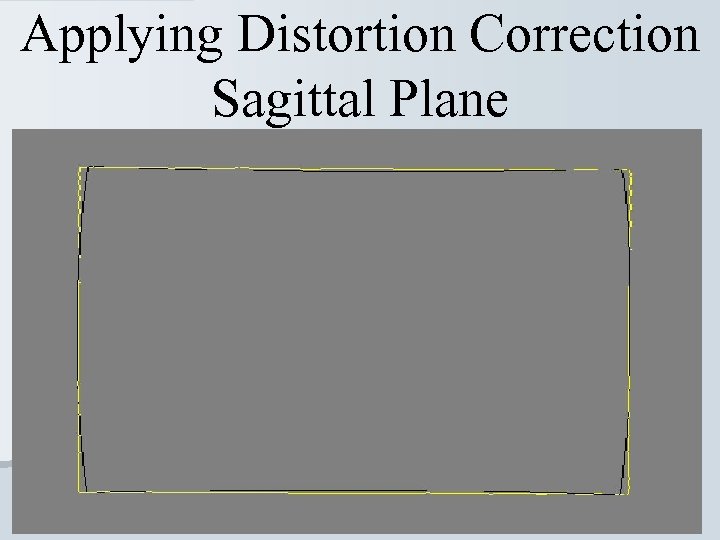 Applying Distortion Correction Sagittal Plane 