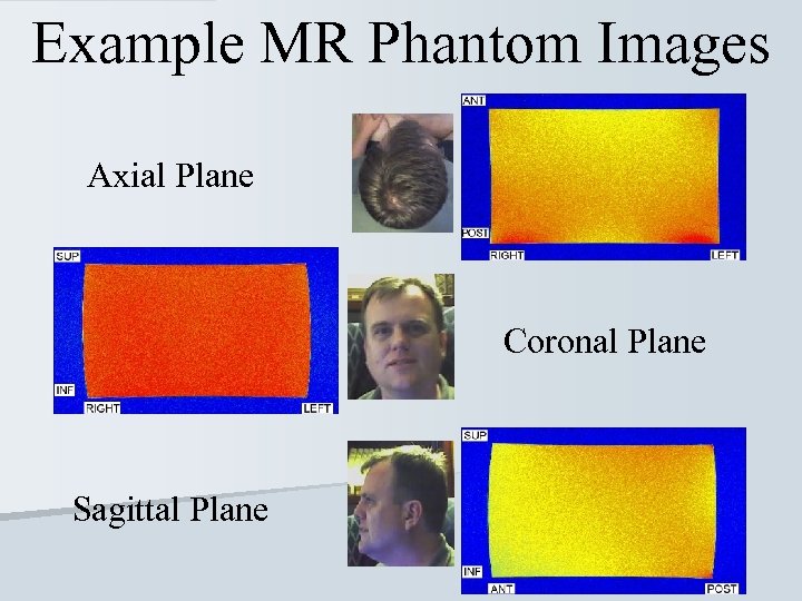 Example MR Phantom Images Axial Plane Coronal Plane Sagittal Plane 