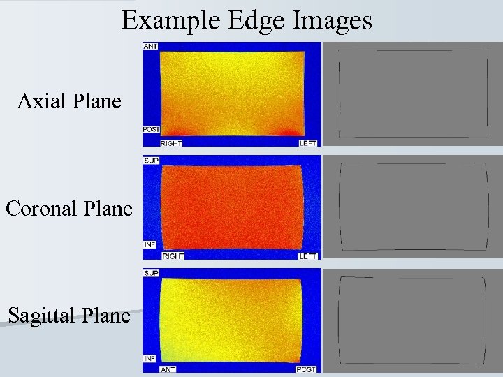 Example Edge Images Axial Plane Coronal Plane Sagittal Plane 