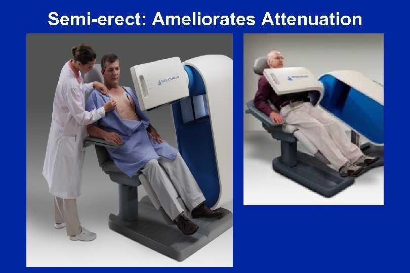 Semi-erect: Ameliorates Attenuation 