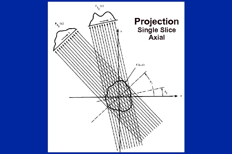 Projection Single Slice Axial 