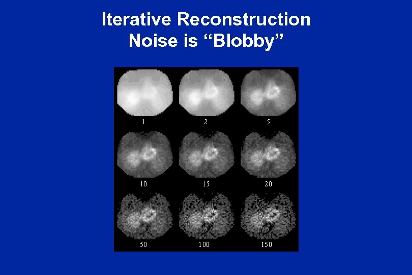 Iterative Reconstruction Noise is “Blobby” 