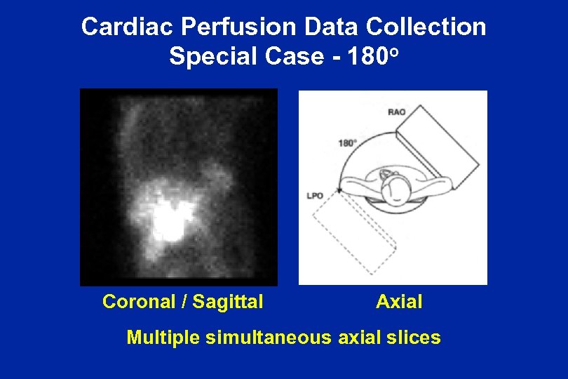 Cardiac Perfusion Data Collection Special Case - 180 o Coronal / Sagittal Axial Multiple