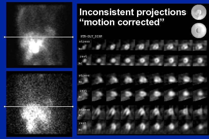 Inconsistent projections “motion corrected” 
