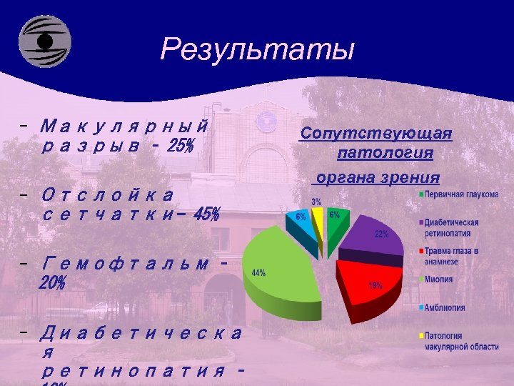 Результаты - Макулярный разрыв – 25% - Отслойка сетчатки- 45% - Гемофтальм – 20%