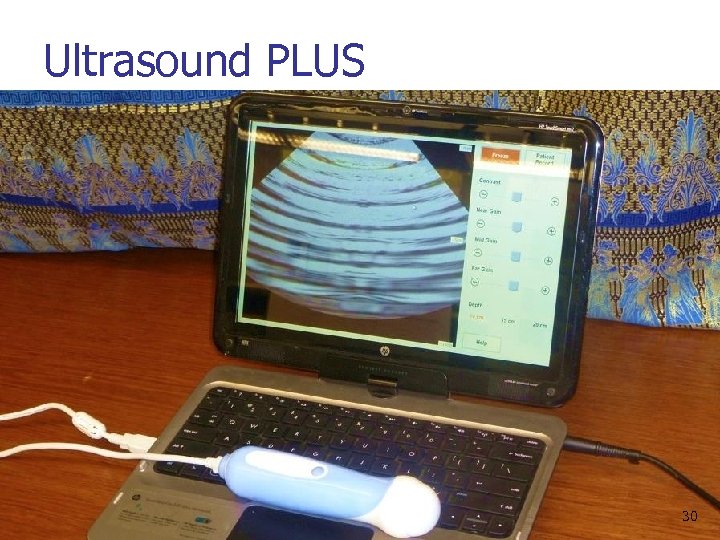 Ultrasound PLUS 30 