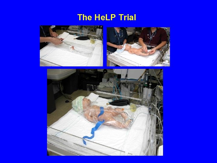 The He. LP Trial 