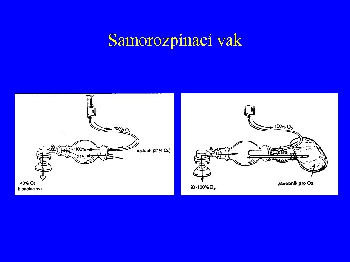 Samorozpínací vak 