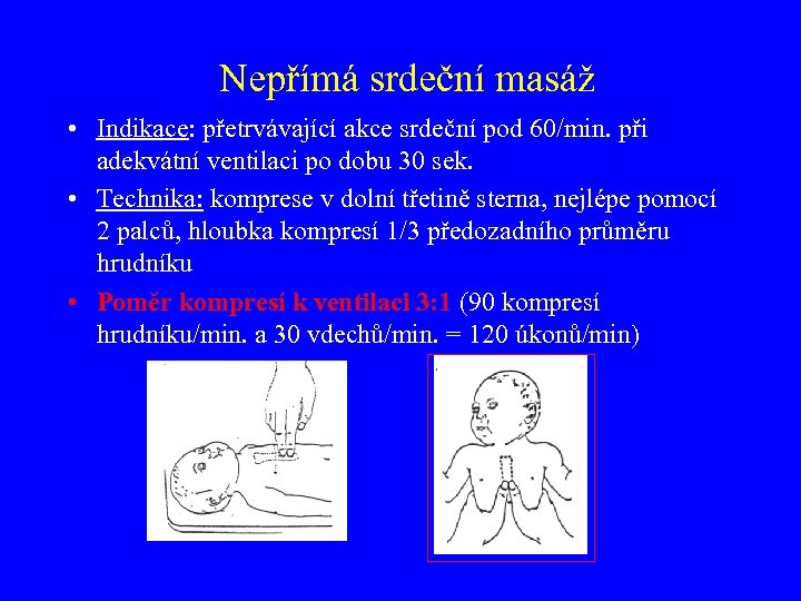 Nepřímá srdeční masáž • Indikace: přetrvávající akce srdeční pod 60/min. při adekvátní ventilaci po