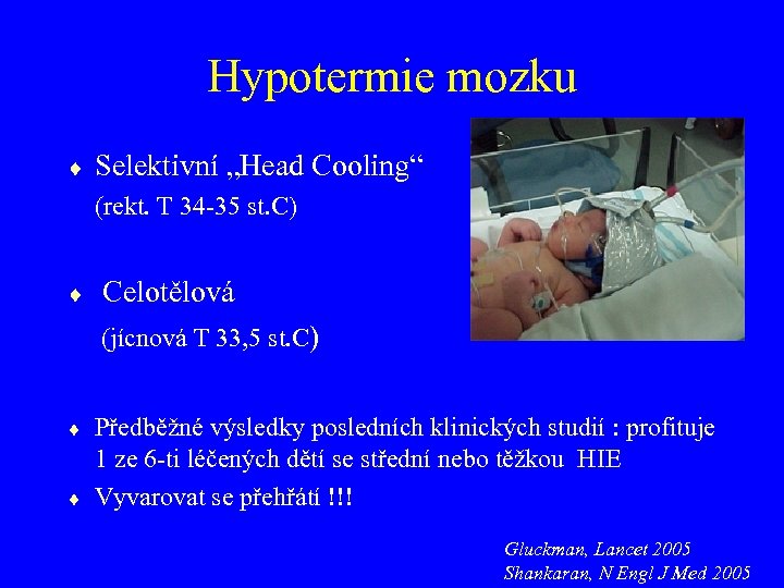 Hypotermie mozku Selektivní „Head Cooling“ (rekt. T 34 -35 st. C) Celotělová (jícnová T