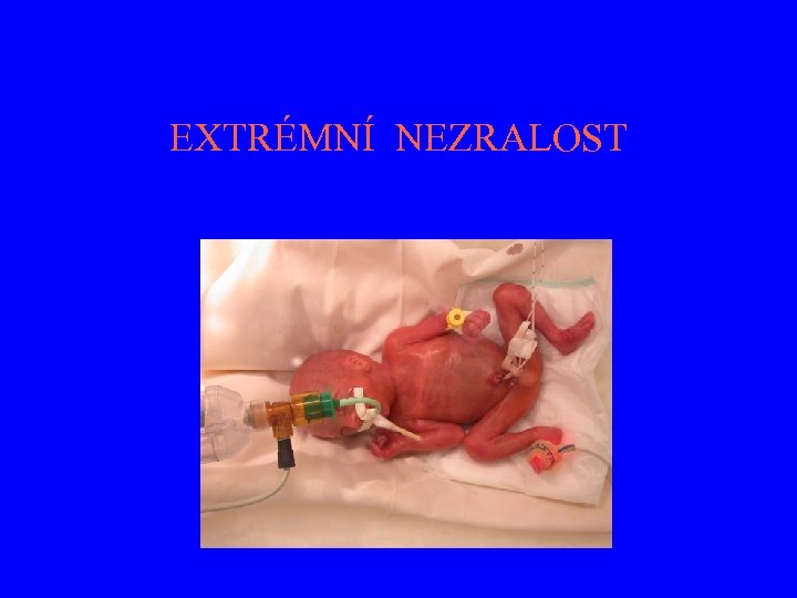 EXTRÉMNÍ NEZRALOST 