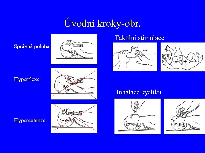 Úvodní kroky-obr. Taktilní stimulace Správná poloha Hyperflexe Inhalace kyslíku Hyperextenze 