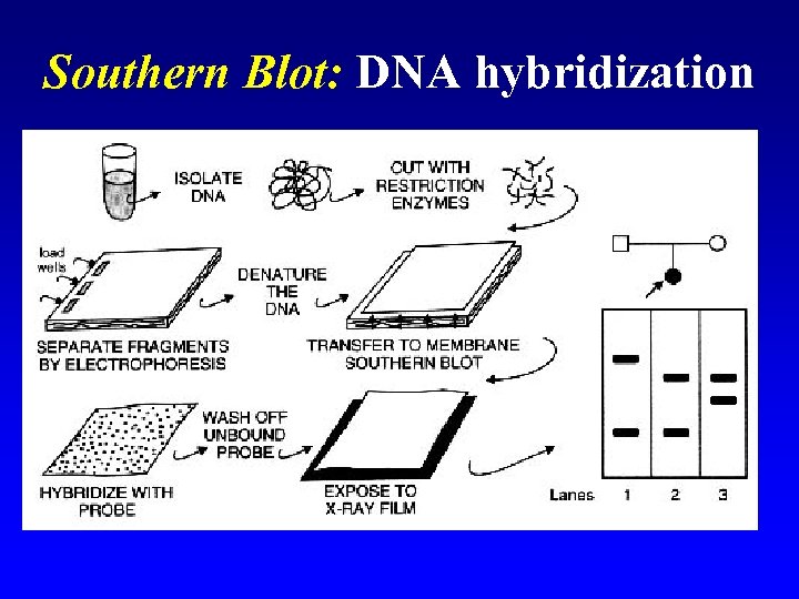 Southern Blot: DNA hybridization 
