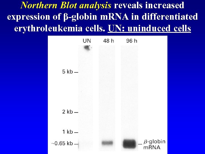 Northern Blot analysis reveals increased expression of β-globin m. RNA in differentiated erythroleukemia cells.
