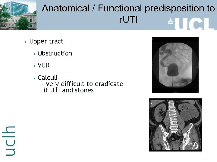 Anatomical / Functional predisposition to r. UTI § Upper tract § Obstruction § VUR