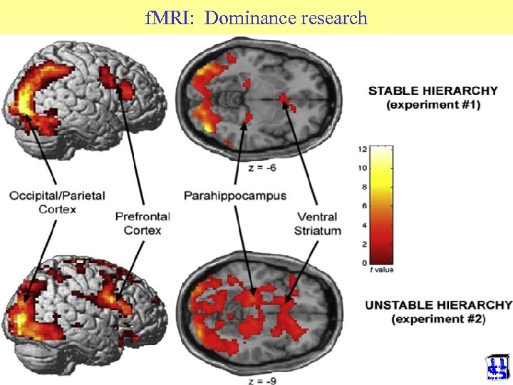 f. MRI: Dominance research © 2014 JP van de Sande Ru. G • Schjelderupp-Ebbe