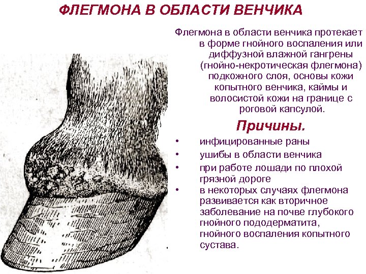 ФЛЕГМОНА В ОБЛАСТИ ВЕНЧИКА Флегмона в области венчика протекает в форме гнойного воспаления или