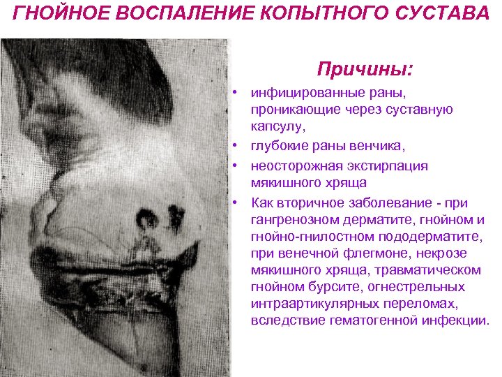 ГНОЙНОЕ ВОСПАЛЕНИЕ КОПЫТНОГО СУСТАВА Причины: • инфицированные раны, проникающие через суставную капсулу, • глубокие