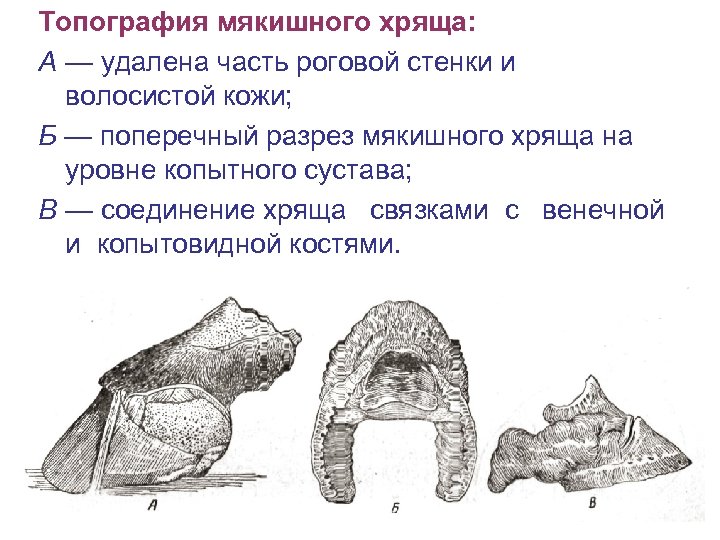 Топография мякишного хряща: А — удалена часть роговой стенки и волосистой кожи; Б —