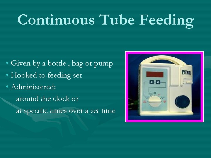 Continuous Tube Feeding • Given by a bottle , bag or pump • Hooked