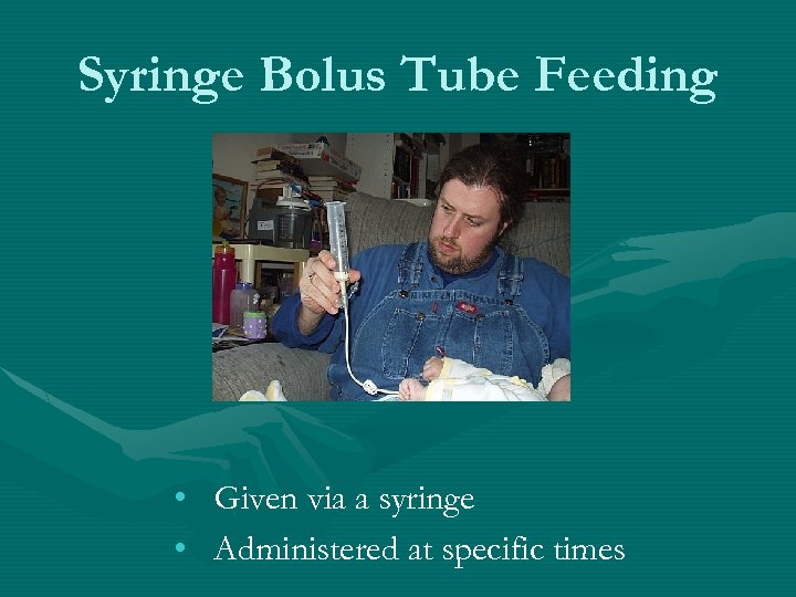 Syringe Bolus Tube Feeding • Given via a syringe • Administered at specific times