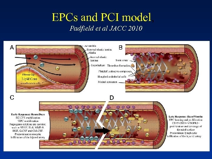 EPCs and PCI model, Padfield et al JACC 2010 