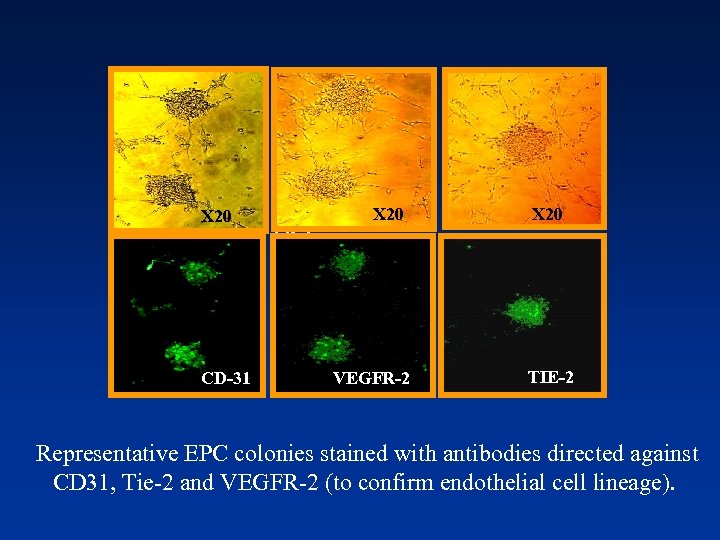 X 20 CD-31 X 20 Tei-2 VEGFR-2 TIE-2 Representative EPC colonies stained with antibodies