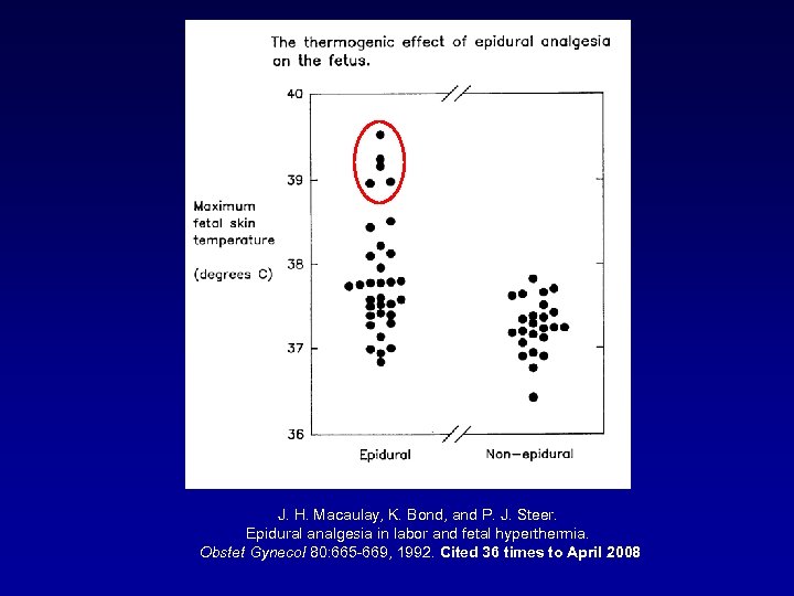 J. H. Macaulay, K. Bond, and P. J. Steer. Epidural analgesia in labor and