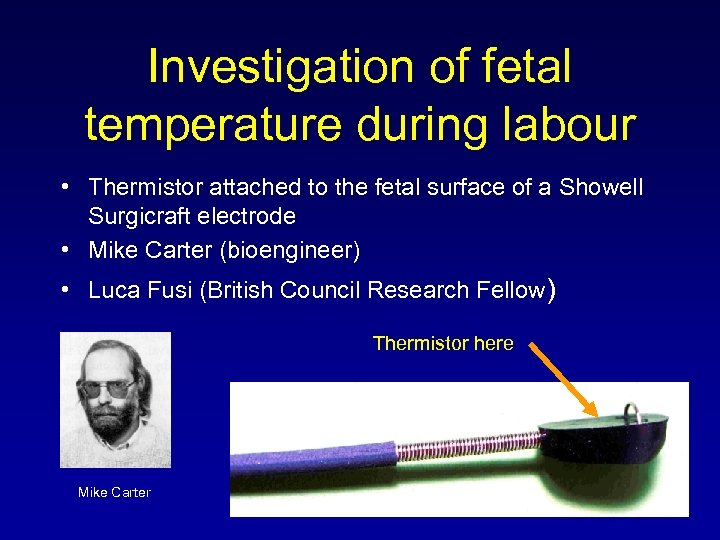 Investigation of fetal temperature during labour • Thermistor attached to the fetal surface of