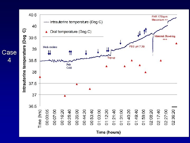 FHR 175 bpm Meconium ++ Maternal Shivering +++ FBS p. H 7. 39 Neck