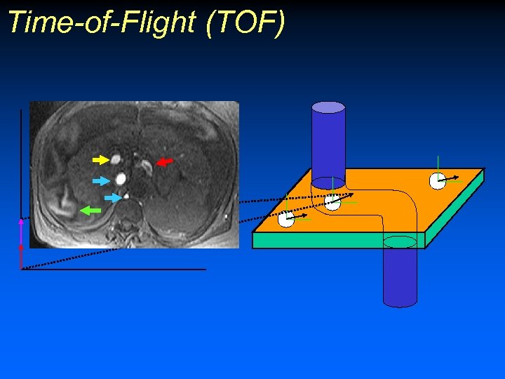 Time-of-Flight (TOF) 