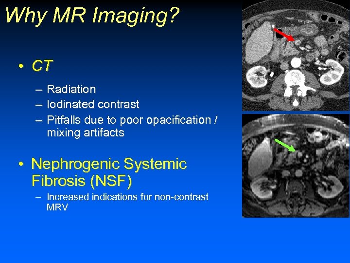 Why MR Imaging? • CT – Radiation – Iodinated contrast – Pitfalls due to