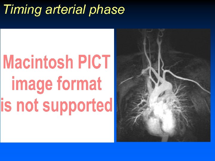 Timing arterial phase 