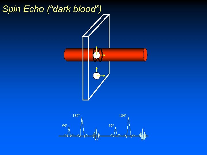 Spin Echo (“dark blood”) 180º 90º 