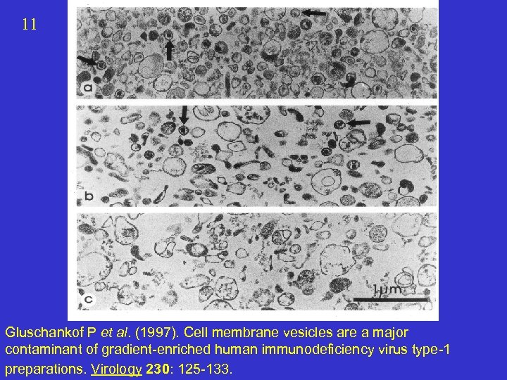 11 Gluschankof P et al. (1997). Cell membrane vesicles are a major contaminant of