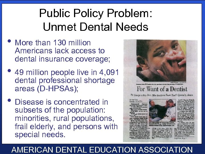 Public Policy Problem: Unmet Dental Needs • More than 130 million Americans lack access