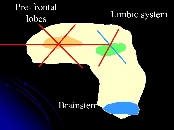 Pre-frontal lobes Limbic system Brainstem 