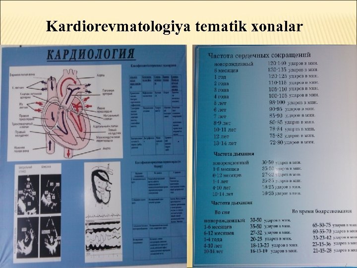 Kardiorevmatologiya tematik xonalar 