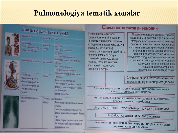 Pulmonologiya tematik xonalar 