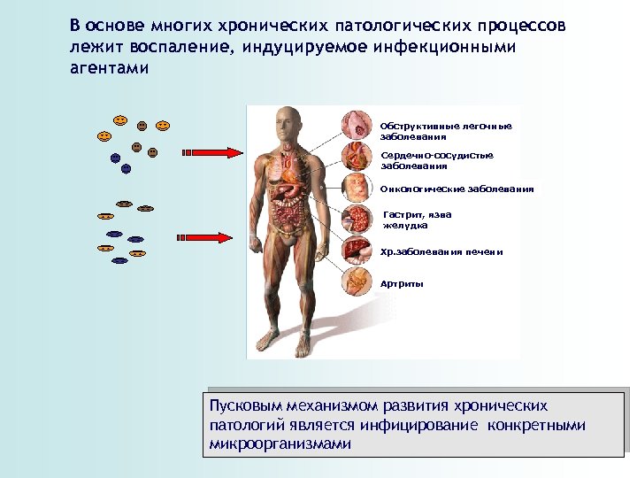 В основе многих хронических патологических процессов лежит воспаление, индуцируемое инфекционными агентами Обструктивные легочные заболевания