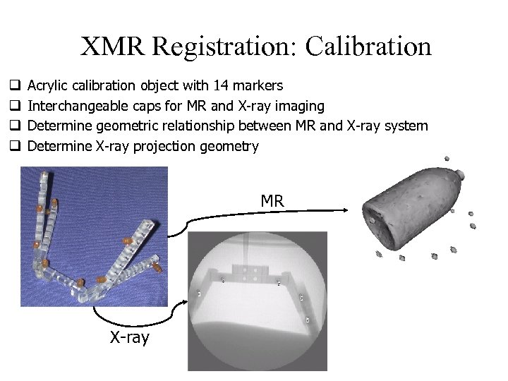 XMR Registration: Calibration q q Acrylic calibration object with 14 markers Interchangeable caps for