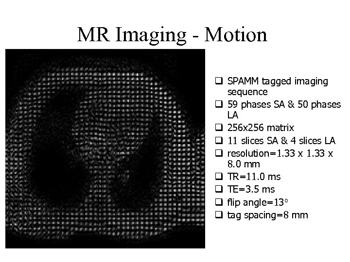 MR Imaging - Motion q SPAMM tagged imaging sequence q 59 phases SA &