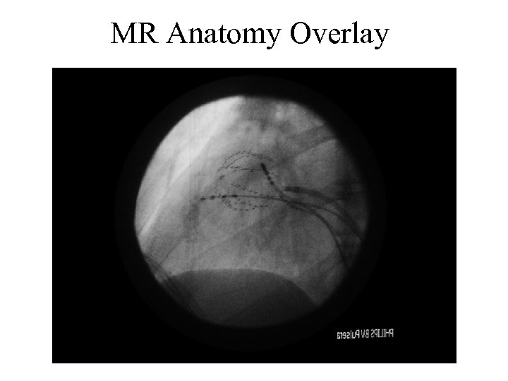 MR Anatomy Overlay 