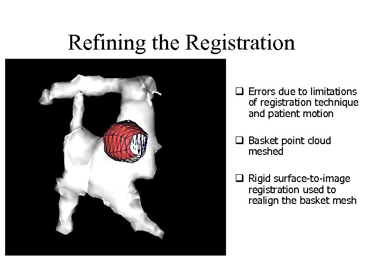 Refining the Registration q Errors due to limitations of registration technique and patient motion