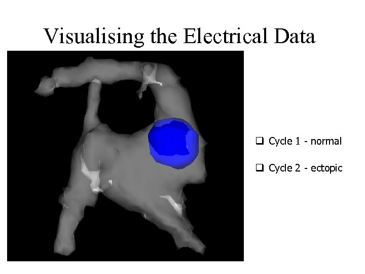 Visualising the Electrical Data q Cycle 1 - normal q Cycle 2 - ectopic