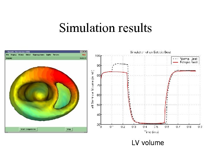 Simulation results LV volume 