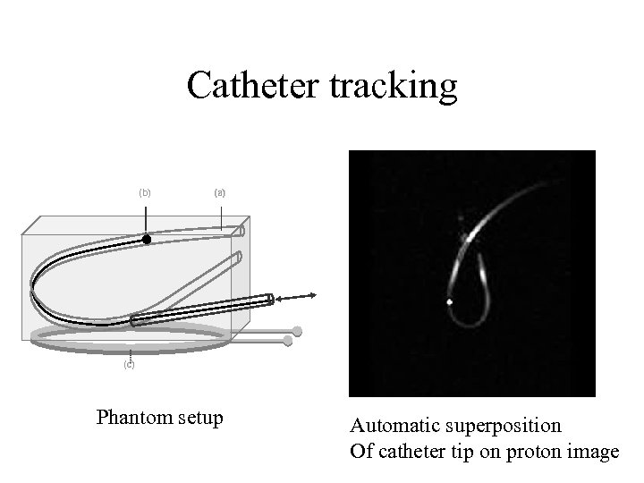 Catheter tracking (b) (a) (c) Phantom setup Automatic superposition Of catheter tip on proton