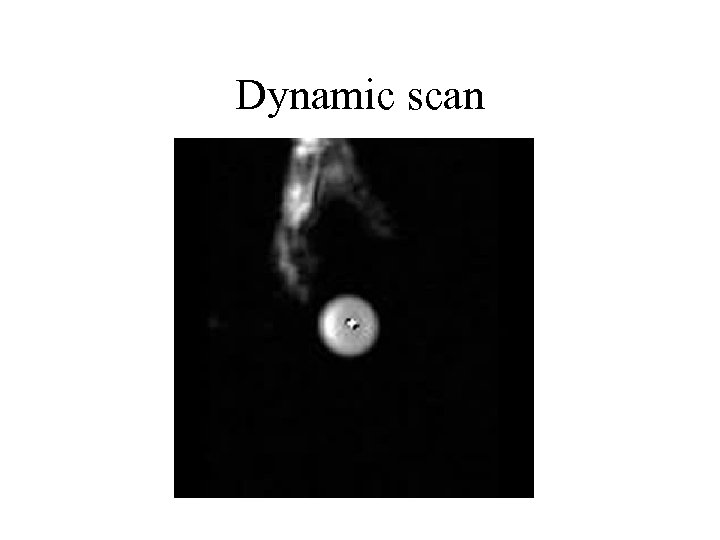 Dynamic scan 